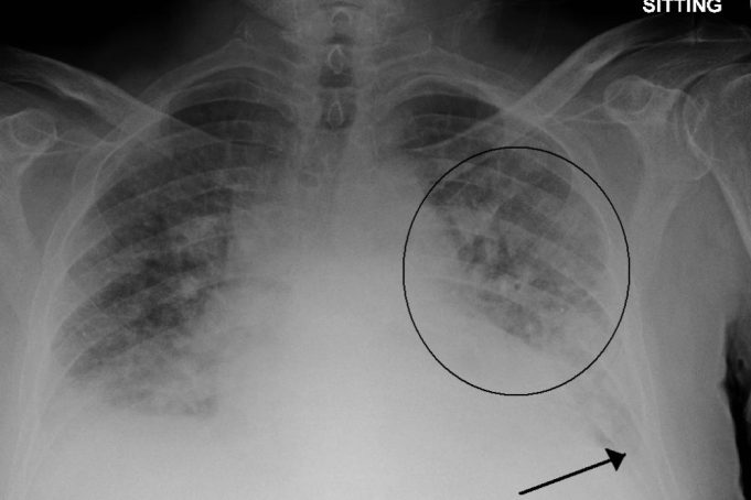 An X-ray image