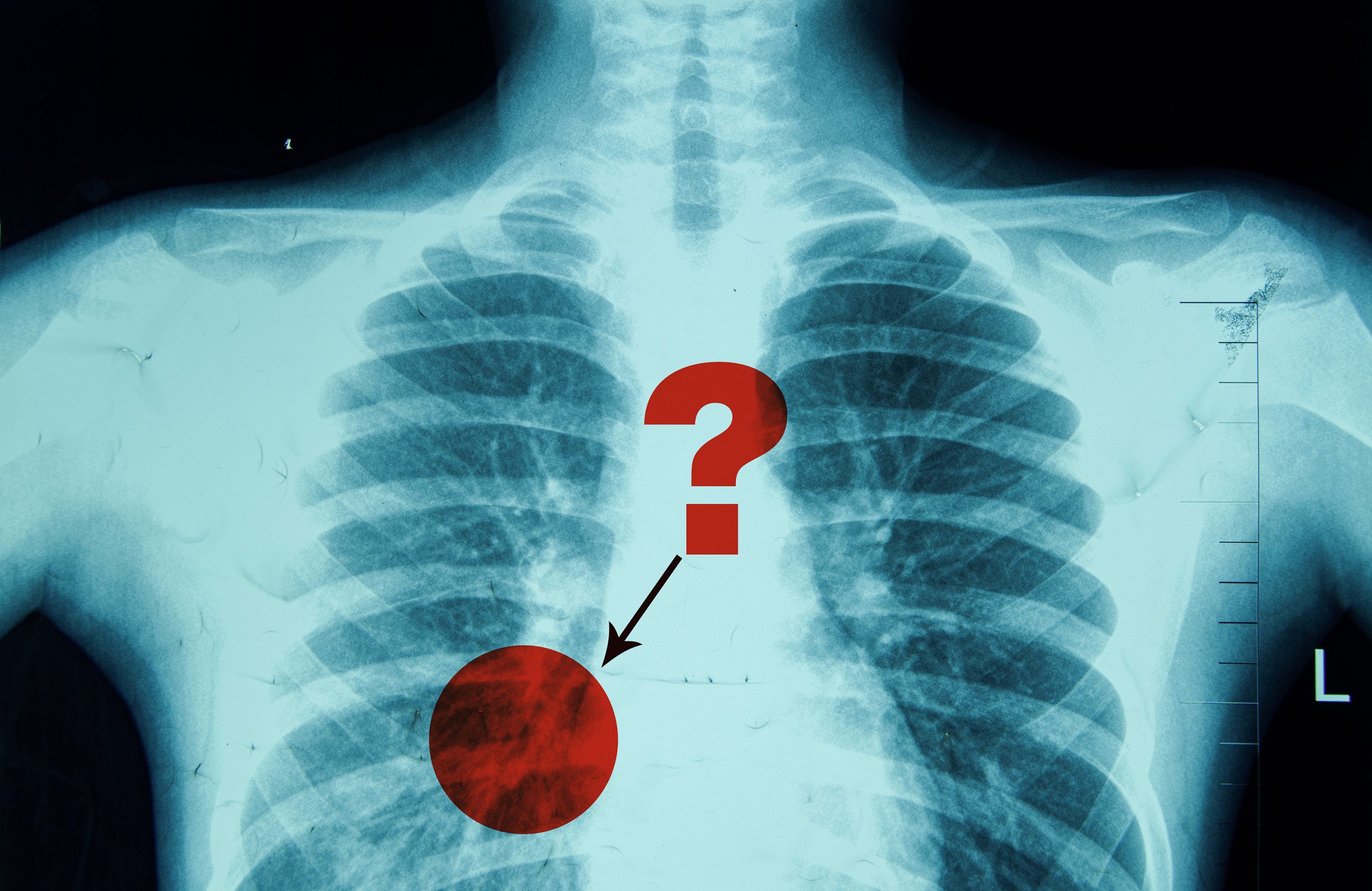 New method assesses and improves the reliability of radiologists